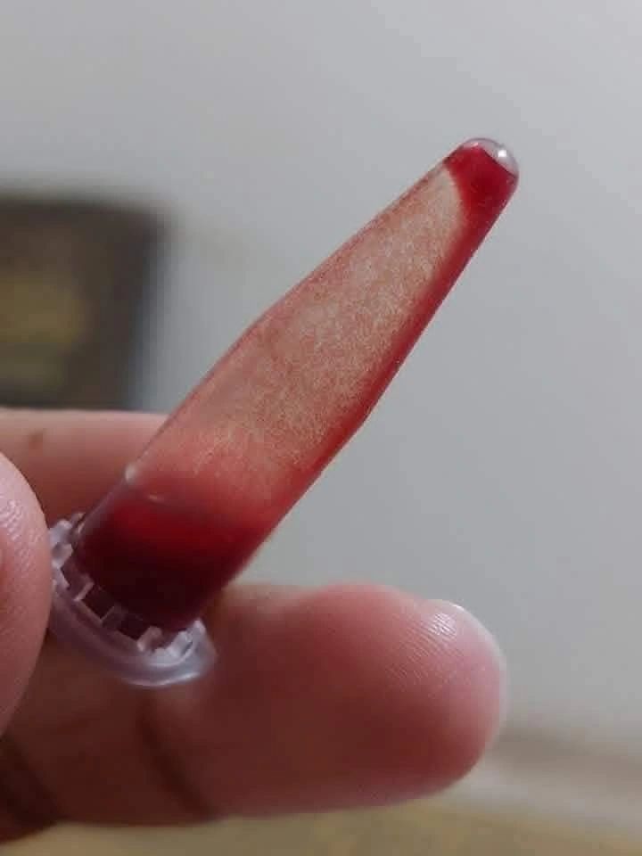 Tareq Abadl on CAD: A Practical Guide to Suspicion, Confirmation, and Correction in the Lab 1 Tareq Abadl on CAD: A Practical Guide to Suspicion, Confirmation, and Correction in the Lab