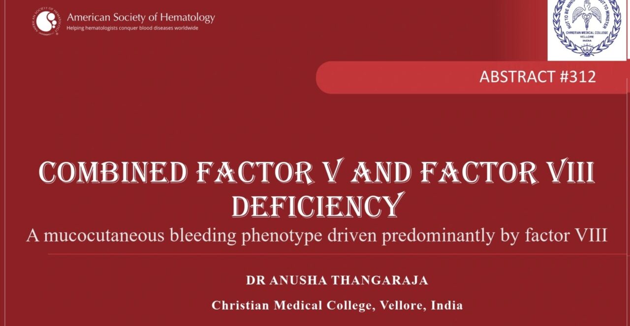 Anusha T's First ASH Presentation: Combined Factor V and VIII Deficiency 1 Anusha T's First ASH Presentation: Combined Factor V and VIII Deficiency