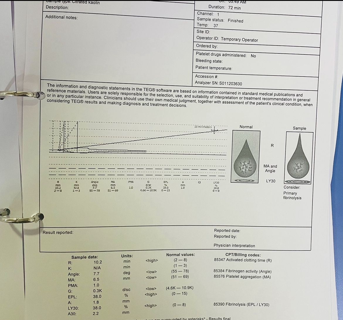 Priya Prasad: A Night in the ER - When a Snakebite Teaches You the Power of Viscoelastic Testing 2 Priya Prasad: A Night in the ER - When a Snakebite Teaches You the Power of Viscoelastic Testing