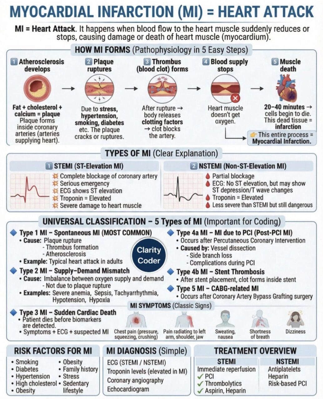 Short and Informative About Myocardial Infarction by Nassim Emteir: What is It and What to Do 1 Short and Informative About Myocardial Infarction by Nassim Emteir: What is It and What to Do