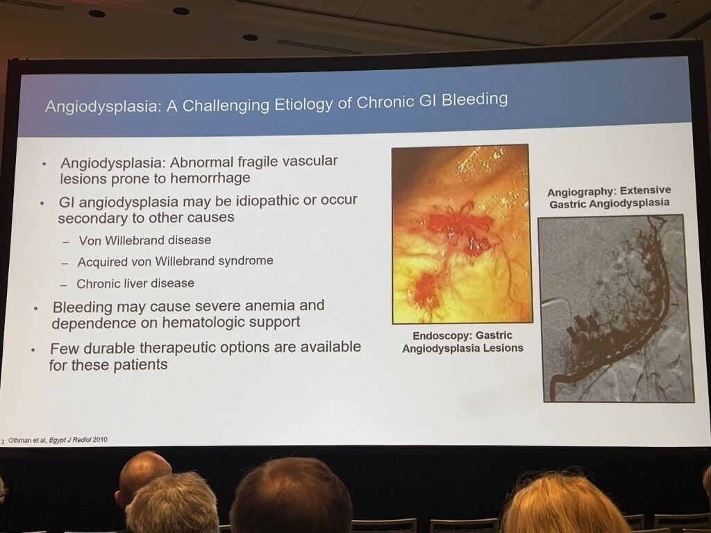 Wolfgang Miesbach - Targeting VEGF to Stop GI Bleeding: Systemic Bevacizumab