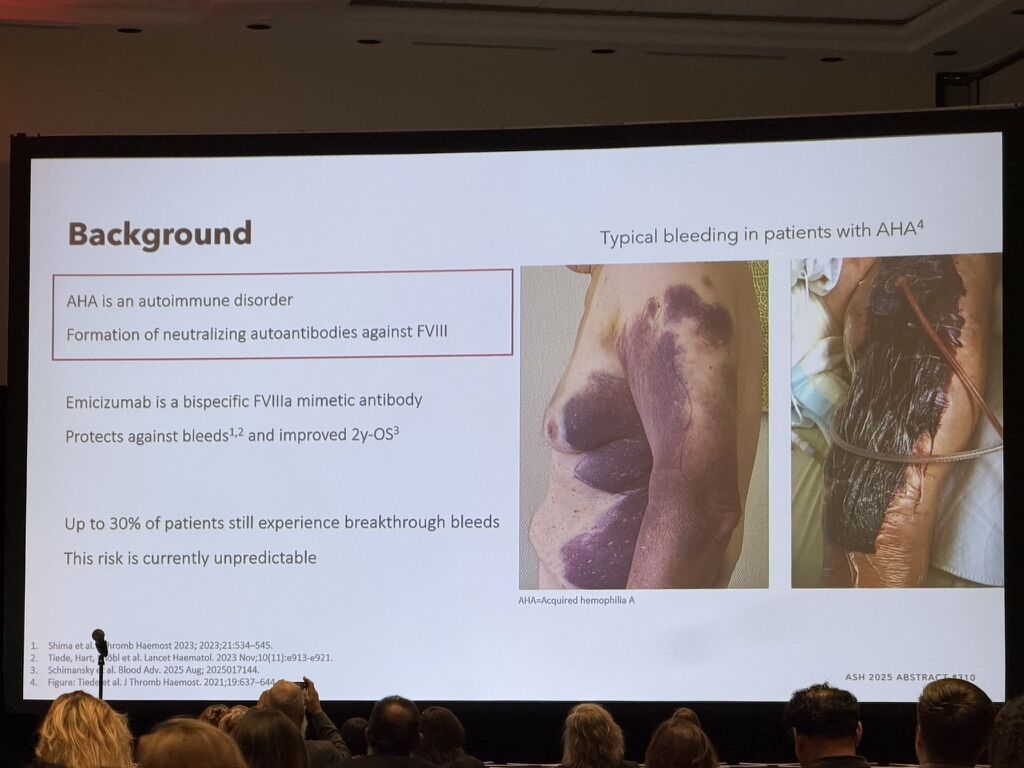 Wolfgang Miesbach: Predicting Breakthrough Bleeding in Emicizumab-Treated Acquired Haemophilia A 1 Wolfgang Miesbach: Predicting Breakthrough Bleeding in Emicizumab-Treated Acquired Haemophilia A