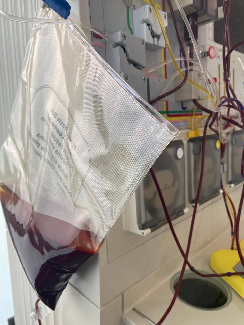 Maxime Dely: What If One Technology Could Transform Patients' Lives? 1 Maxime Dely: What If One Technology Could Transform Patients' Lives?