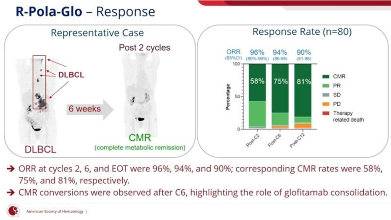 ASH25 Day 1: Don't Miss The Highlights