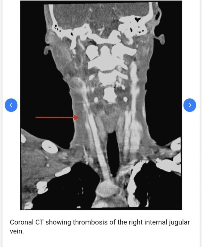 A Unique Case Quizz from Khaled Kandil