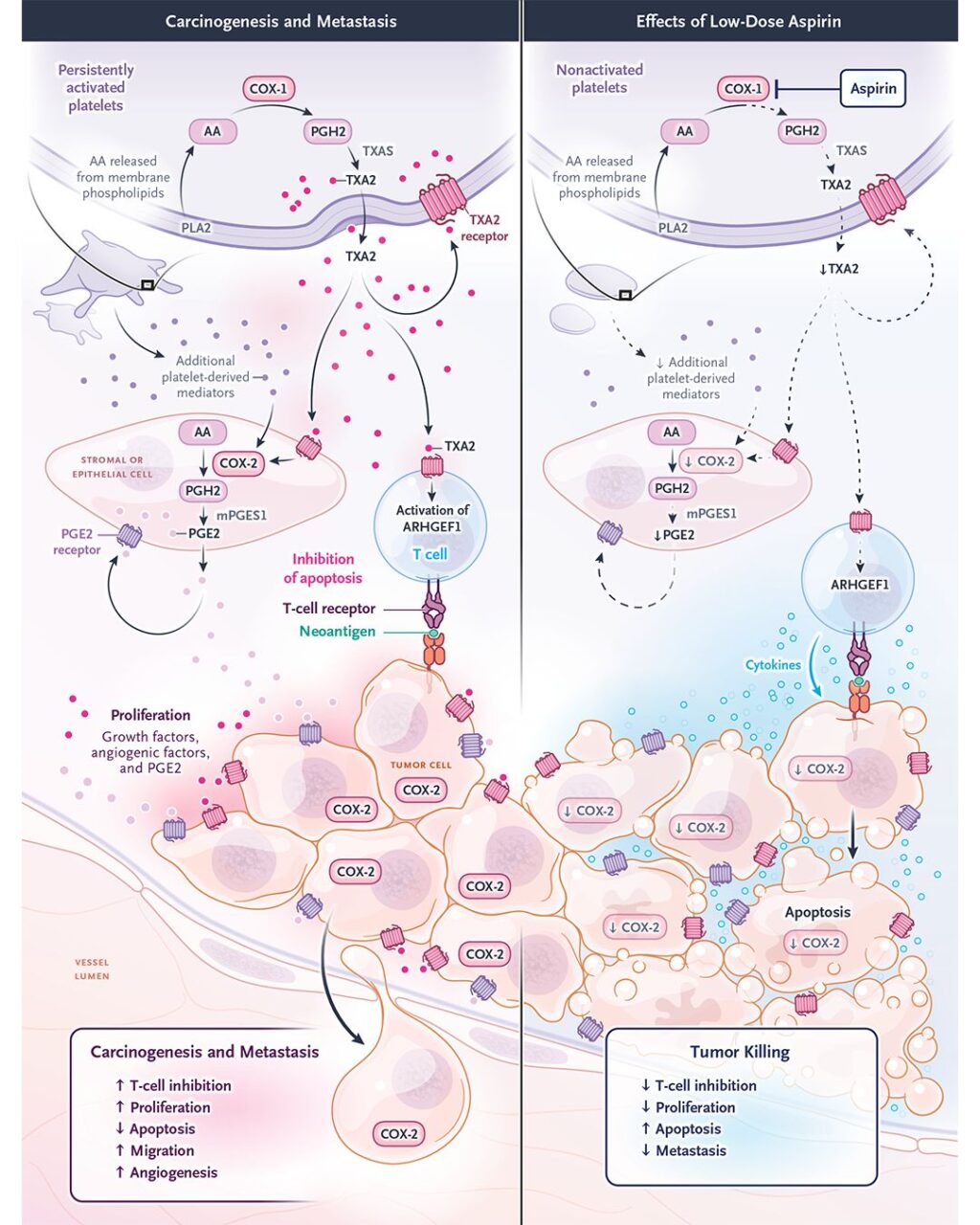 Andreas Tiede on Antithrombotic Drugs and Their Role in Cancer Progression and Metastasis 1 Andreas Tiede on Antithrombotic Drugs and Their Role in Cancer Progression and Metastasis