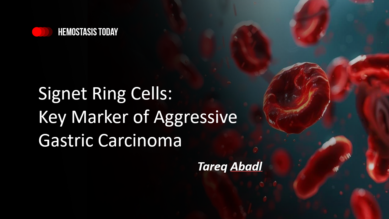 Signet Ring Cells Explained: Key Marker of Aggressive Gastric Carcinoma