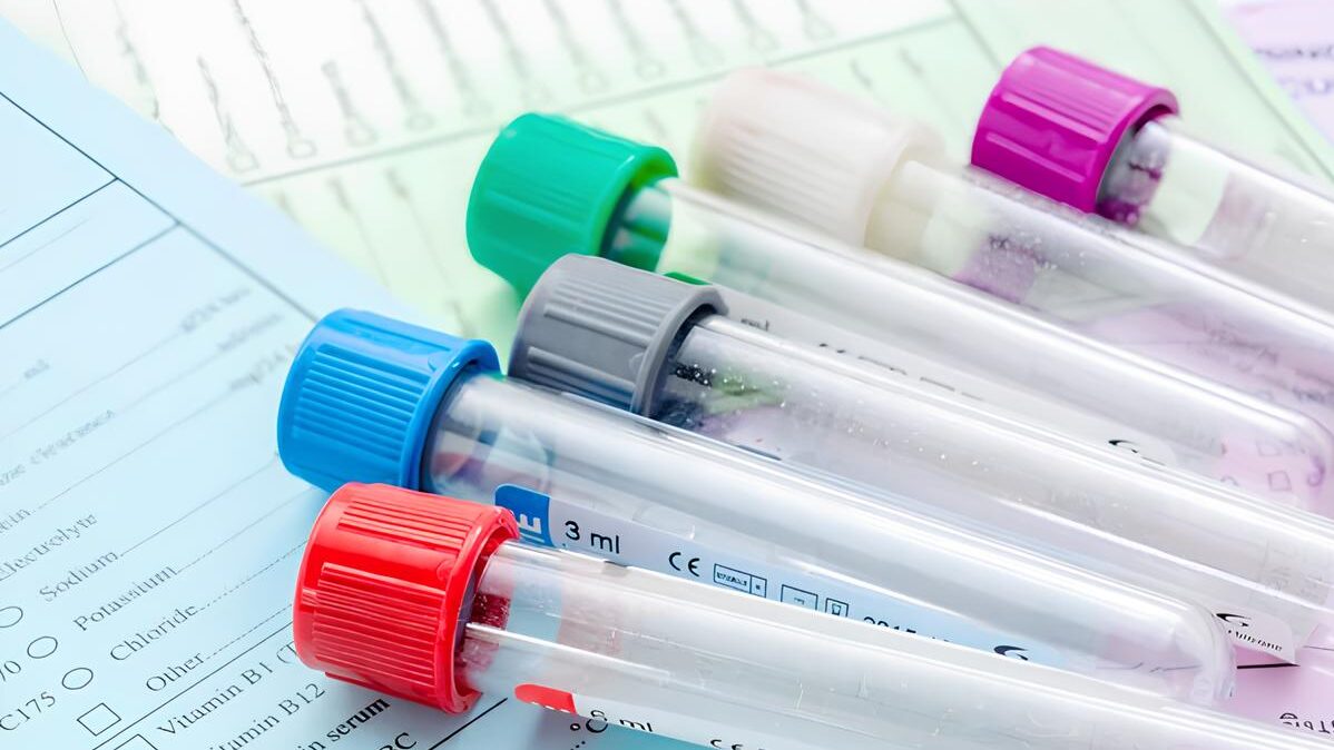 Tareq Abadl: Are Premarital Tests a Luxury Or a Medical Necessity?