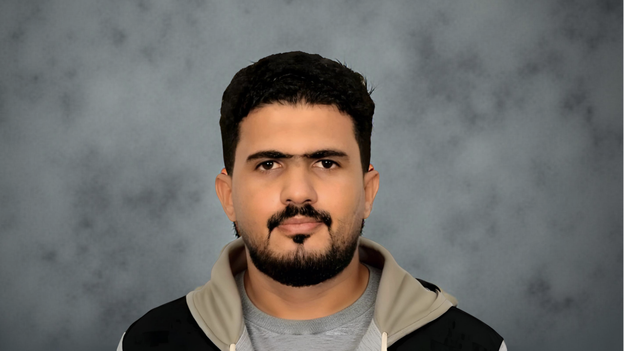 Mazen Abdo A Y. Shares Ultrasound Case from Daily Practice: Liver Cirrhosis with PVT