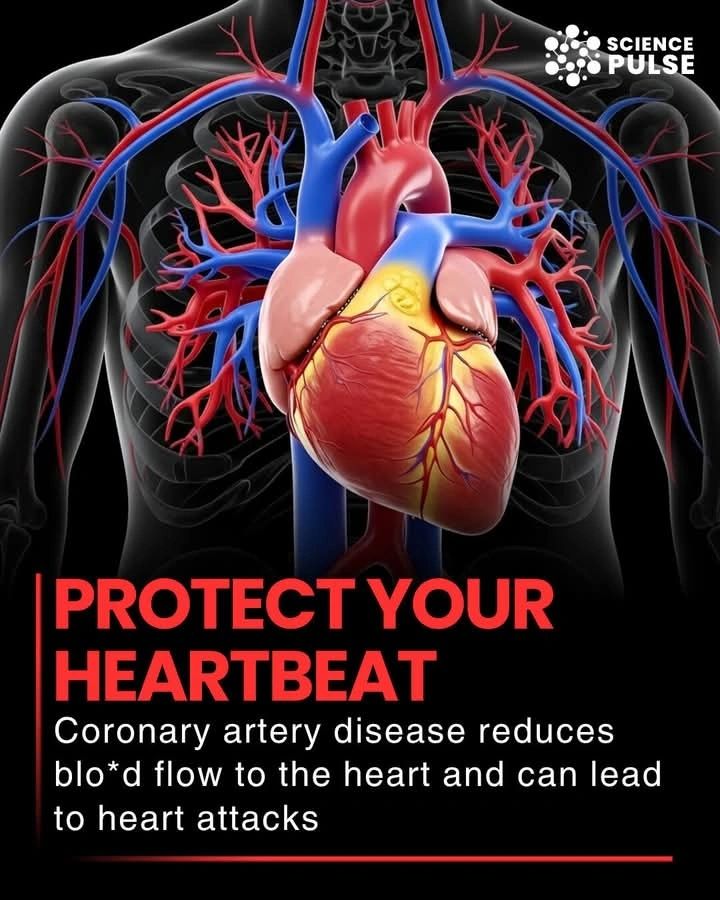 Ewang Yemi: CAD is Real and Dangerous - Keep Your Heart Beating