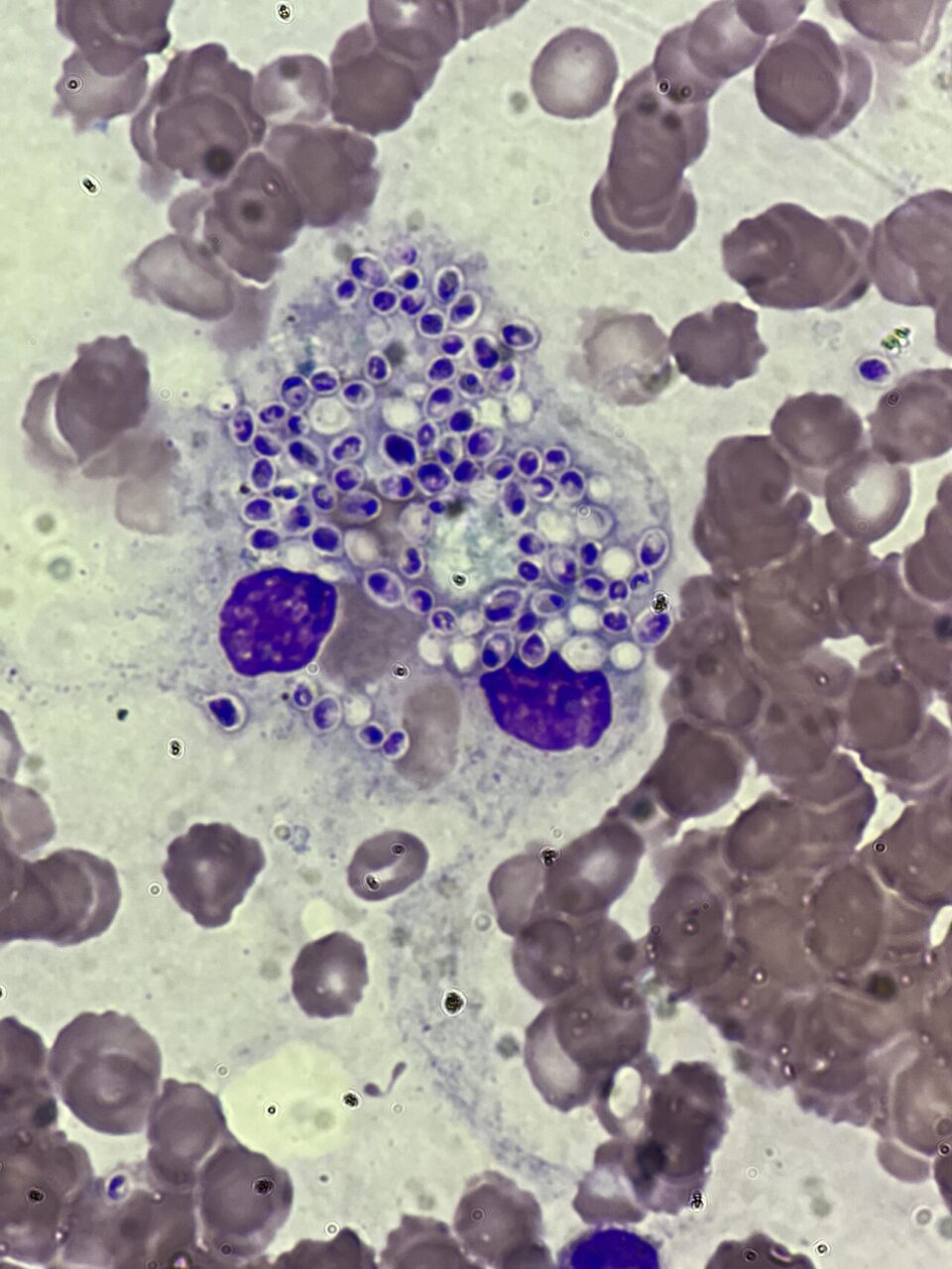 Surbhi Singh: A Powerful Case Where Multidisciplinary Teamwork Truly Saved a Life 2 Surbhi Singh: A Powerful Case Where Multidisciplinary Teamwork Truly Saved a Life