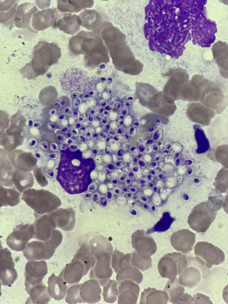 Surbhi Singh: A Powerful Case Where Multidisciplinary Teamwork Truly Saved a Life 1 Surbhi Singh: A Powerful Case Where Multidisciplinary Teamwork Truly Saved a Life