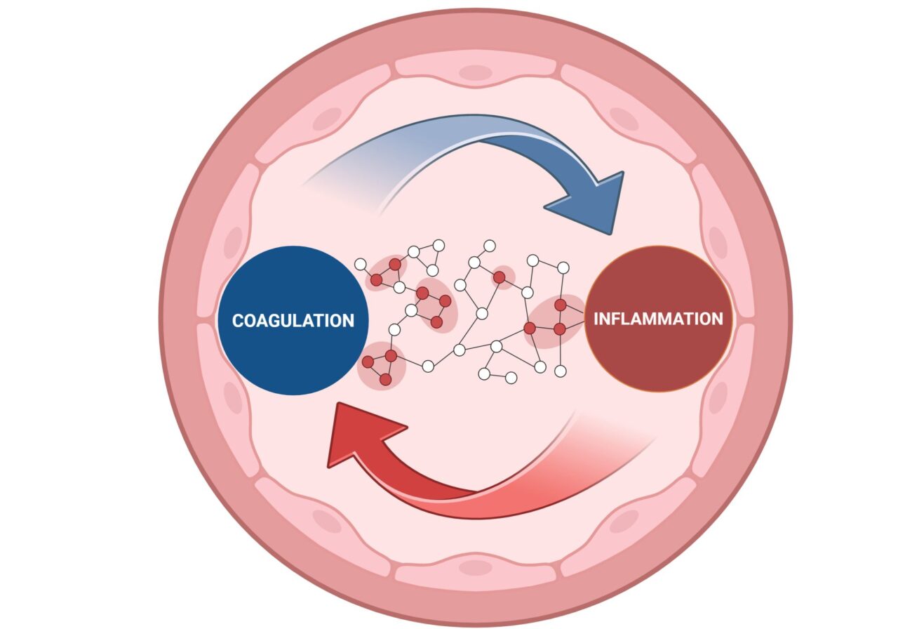 Hamideh Yadegari: Coagulation–Inflammation Crosstalk: Mechanisms, Pathways, and Clinical Implications