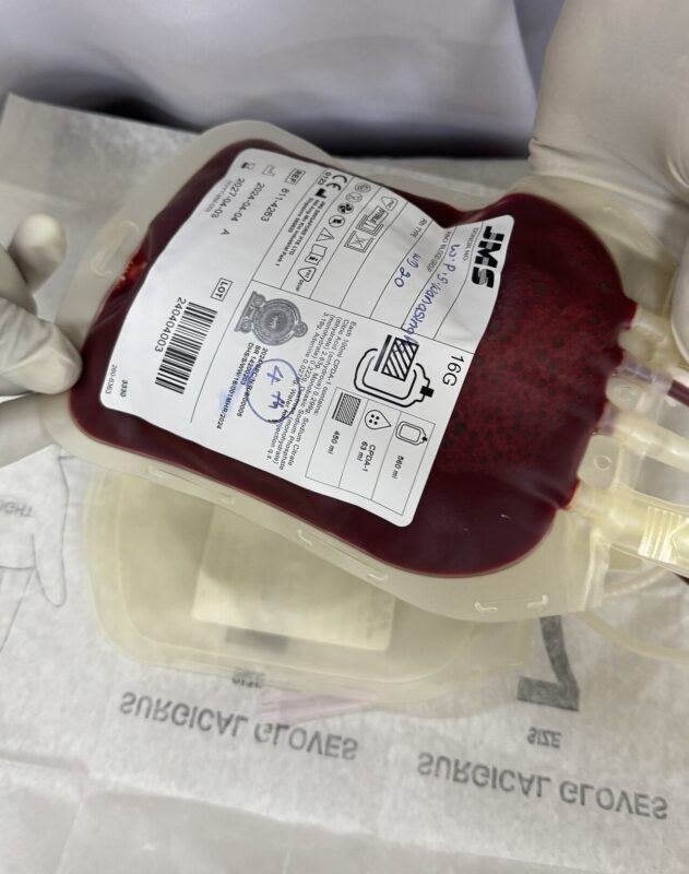 Wathsala Manindrani Gives a A Practical Perspective on Red Cell Exchange Transfusion