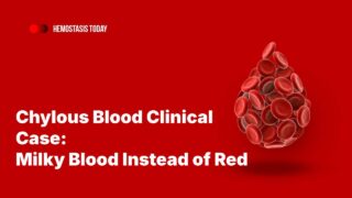 Sifat Jubaira Shares Chylous Blood Clinical Case: Milky Blood Instead of Red