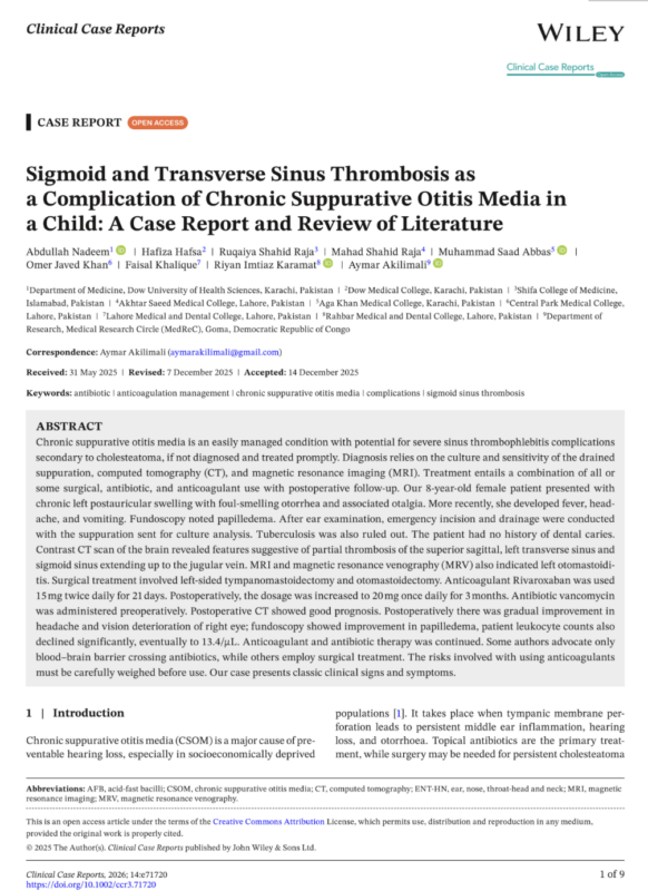 Aymar Akilimali on An Unusual Case of Sinus Thrombosis Associated with Otitis Media 1 Aymar Akilimali on An Unusual Case of Sinus Thrombosis Associated with Otitis Media