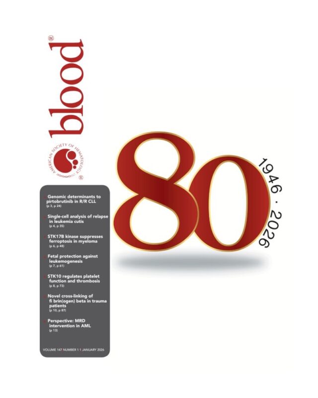 Emilia Arturo: I'm Massively Proud to Be the Senior Managing Editor of the Blood Journal! 1 Emilia Arturo: I'm Massively Proud to Be the Senior Managing Editor of the Blood Journal!