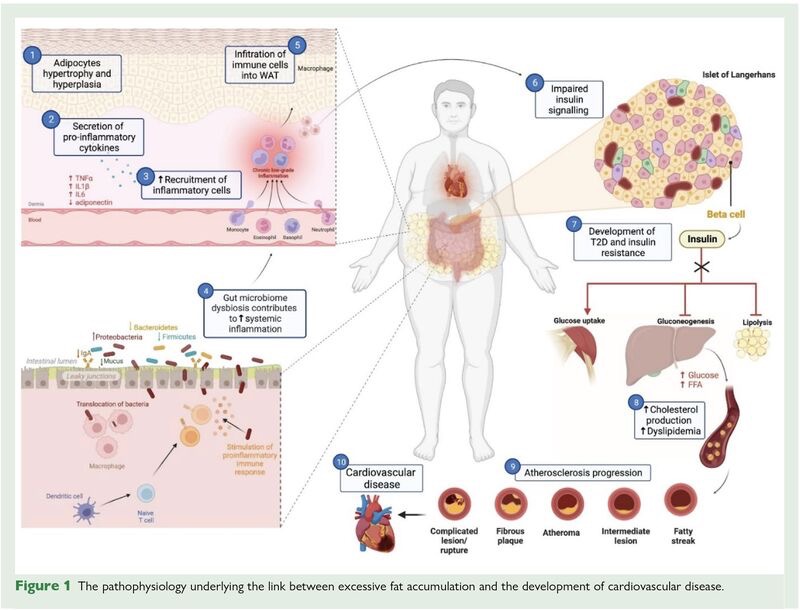 Dario Tuccinardi on Obesity as Cardiovascular Treatment Target