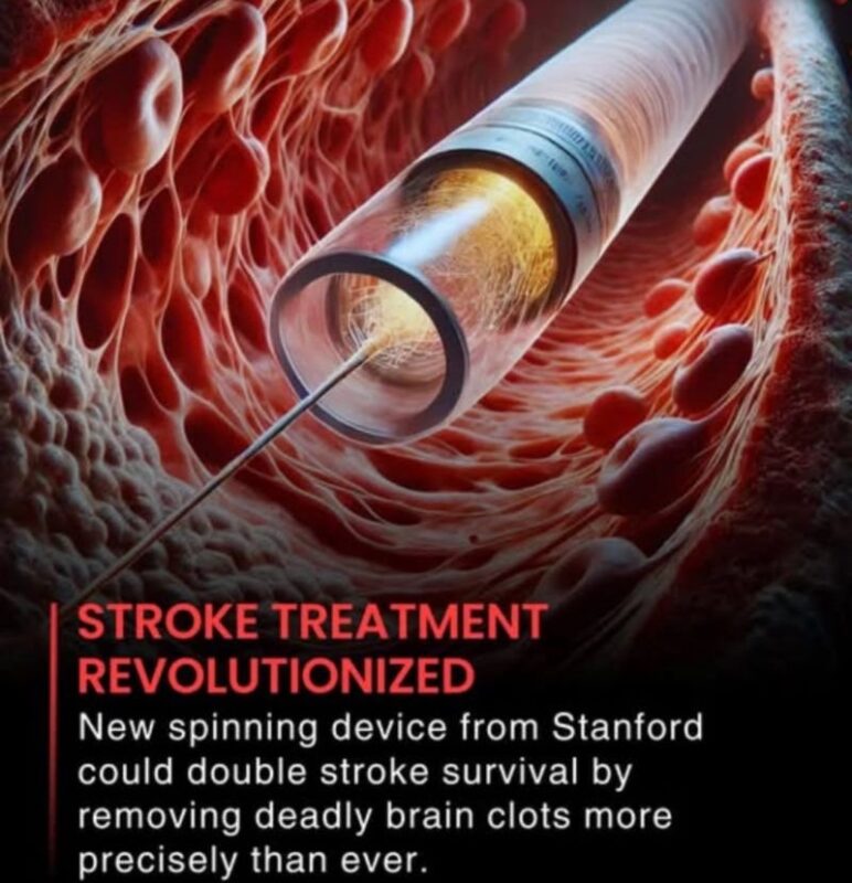 Nasrin Haghani on The Milli-Spinners: Breakthrough Technology Transforming Stroke Clot Removal