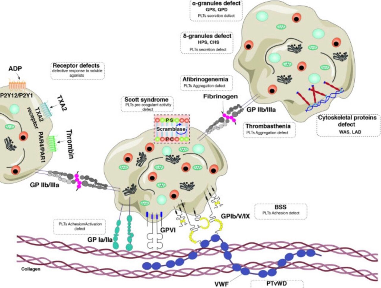 Shadi Tabibian: Molecular Diagnosis of Inherited Platelet Disorders 2 Shadi Tabibian: Molecular Diagnosis of Inherited Platelet Disorders