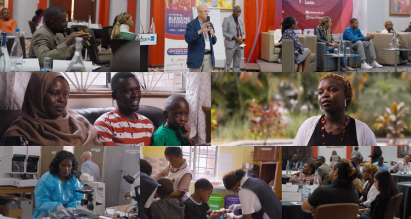 Building Better Care for Bleeding Disorders in Zambia․ Chatowa’s Journey 1 Bleeding Disorders