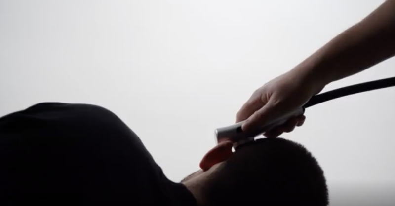 Lucien Blondel on Resolve Stroke: To Be Used In the SCULPT Trial