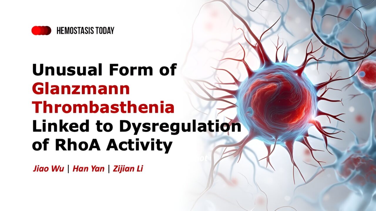 Alan Nurden Shares A Study on Unusual Form of Glanzmann Thrombasthenia