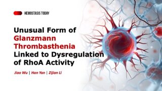 Alan Nurden Shares A Study on Unusual Form of Glanzmann Thrombasthenia