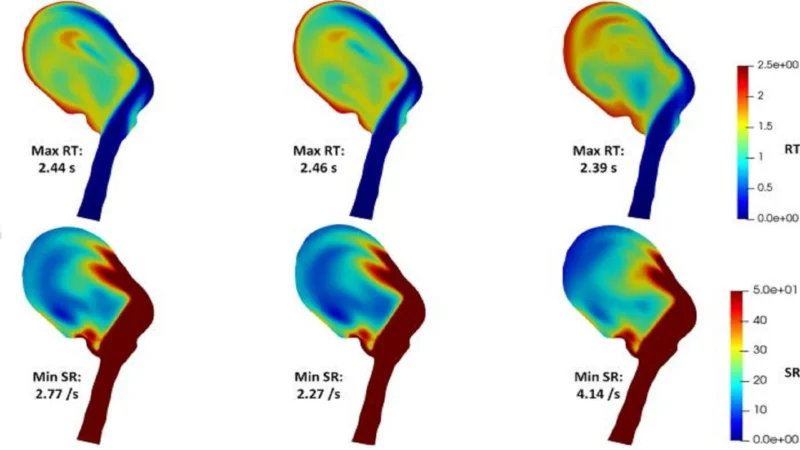 Toni Lassila on Computational Models for Predicting Thrombus Formation 1 Toni Lassila on Computational Models for Predicting Thrombus Formation