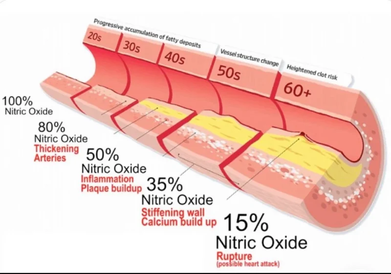Ney Carter Borges: The Central Role of Endothelial Dysfunction in Cardiovascular Disease Progression