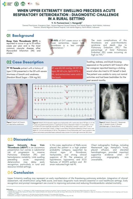 Vicklen Pesiwarissa: Upper Extremity Deep Vein Thrombosis as a Cause of Pulmonary Embolism 1 Vicklen Pesiwarissa: Upper Extremity Deep Vein Thrombosis as a Cause of Pulmonary Embolism