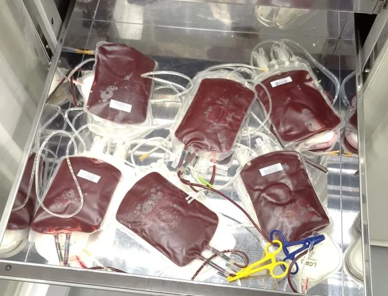 Maxime Dely: Trends in Red Blood Cell Consumption in France