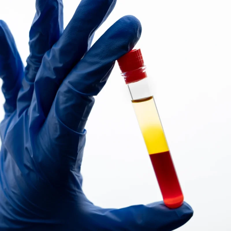 Reza Shojaei: Beyond the Blood - Plasma Divide 1 Reza Shojaei: Beyond the Blood - Plasma Divide