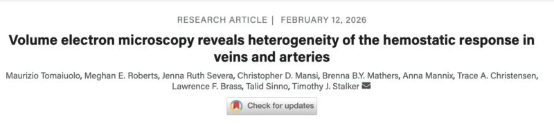Timothy Stalker: Differences Between Arterial and Venous Hemostasis