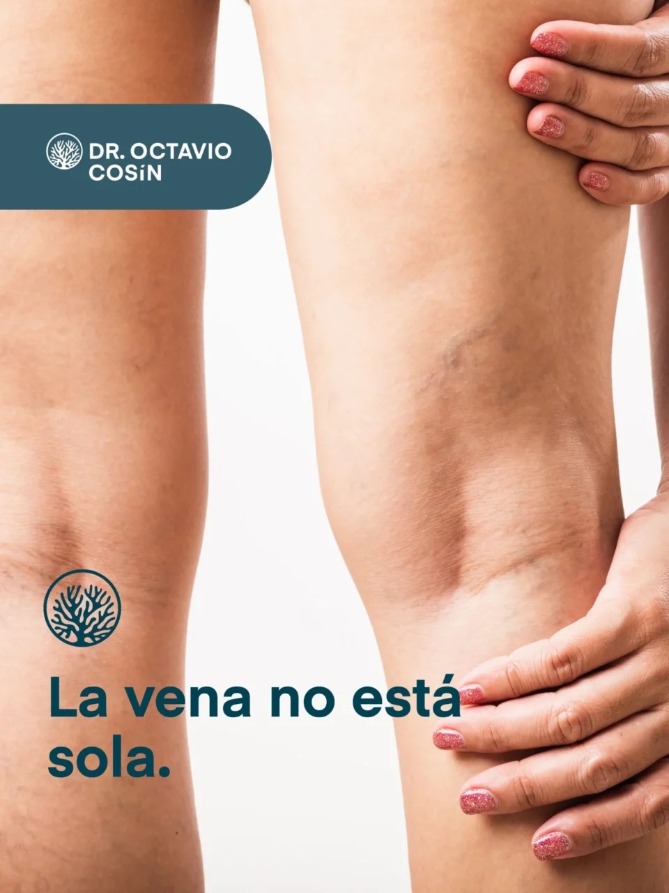 Octavio Cosín Sales: Understanding the Influence of Systemic Factors on Chronic Venous Insufficiency 1 Octavio Cosín Sales