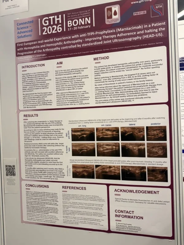 Wolfgang Miesbach: Targeted Anti-TFPI Therapy with Marstacimab Supports Joint Stability in Hemophilia A