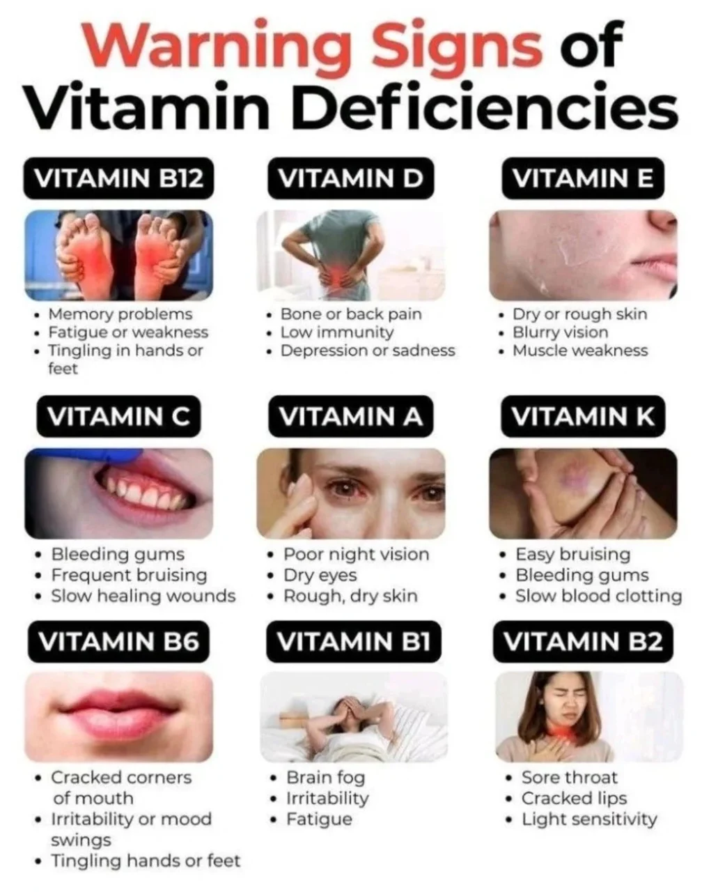 Mohamed Sikkander Abdul Razak: Warning Signs of Vitamin Deficiencies