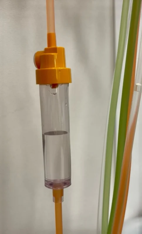 Maxime Dely: Anticoagulant Is an Invisible Yet Essential Ally of Therapeutic Apheresis