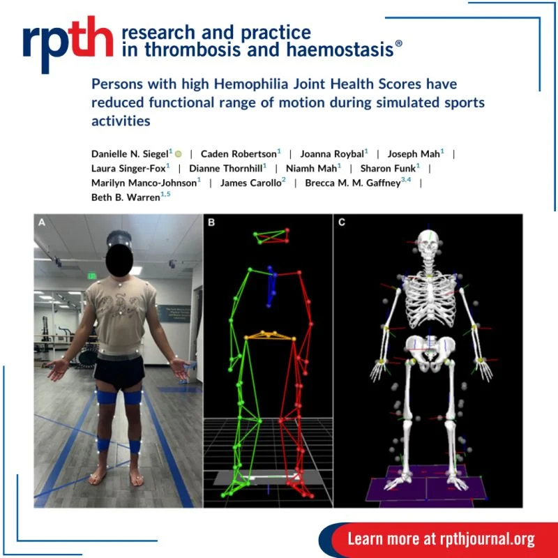 Brecca Gaffney: The Role of Hemophilia Severity on Movement Patterns