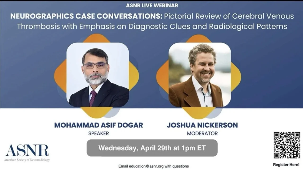 Asif Dogar: Diagnostic Clues and Radiological Patterns of Cerebral Venous Thrombosis In a Coming Webinar