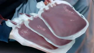 How Clinicians Prioritize Factors in Red Blood Cell Transfusions While Following Guidelines - AABB