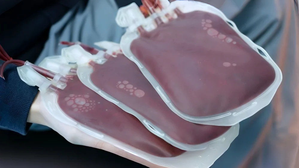 How Clinicians Prioritize Factors in Red Blood Cell Transfusions While Following Guidelines – AABB