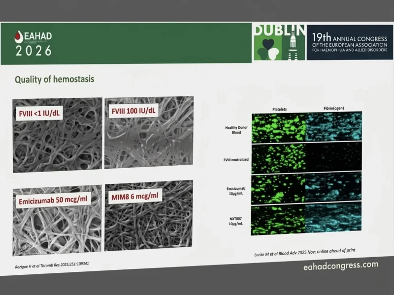 Wolfgang Miesbach: A Remarkable Progress With Non-Factor Therapies in Hemophilia Care 1 Wolfgang Miesbach: A Remarkable Progress With Non-Factor Therapies in Hemophilia Care