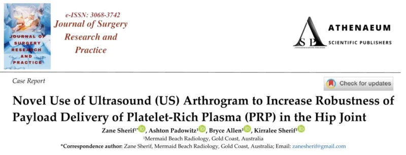Jeannie Devereaux: A Novel Technique for Precise High-Dose PRP Injection in Hip Labral Tear