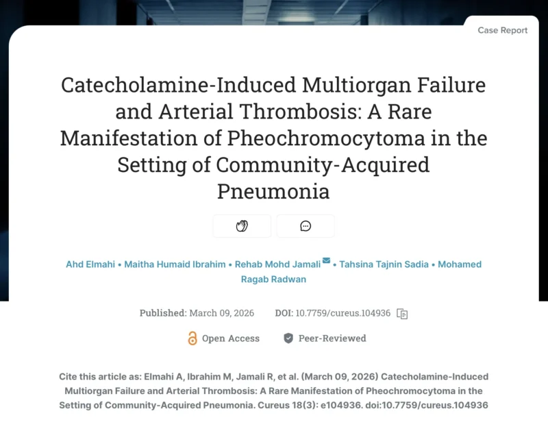 Ahd Elmahi: Complex Case of Catecholamine-Induced Multiorgan Failure and Arterial Thrombosis in Community-Acquired Pneumonia