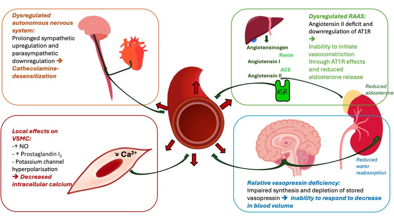Rob Mac Sweeney: Hemodynamic Failure During Sepsis
