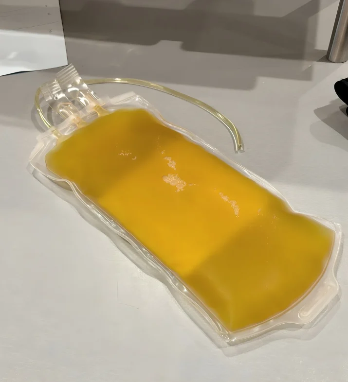 Maxime Dely: Blood Plasma Remains the Only Possible Source of Human Albumin