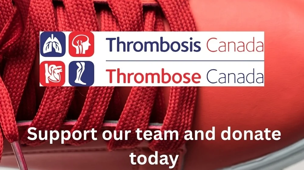 Deborah Siegal: Every Step Counts In The Fight Against Blood Clots 1 Deborah Siegal: Every Step Counts In The Fight Against Blood Clots