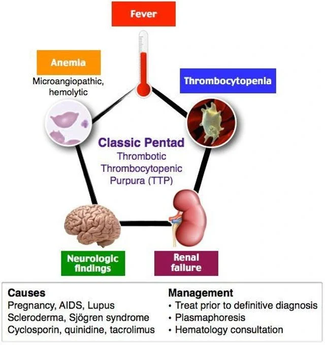 Waqar Ahmad Khan: Clinical Features and Management of TTP 1 Waqar Ahmad Khan: Clinical Features and Management of TTP