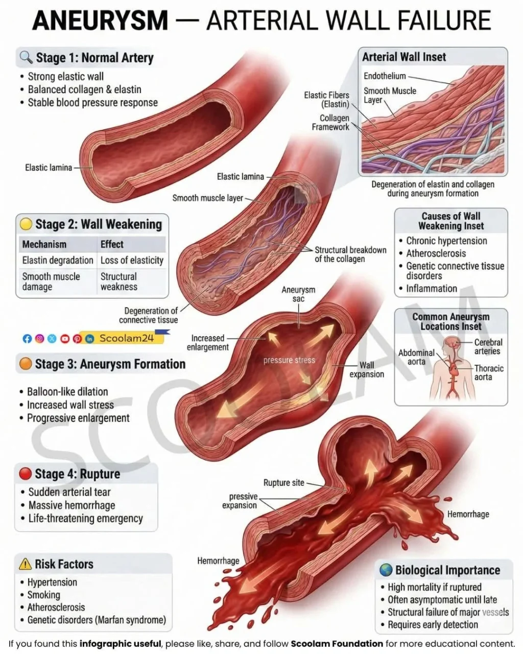 Krishnakant Prasad: Hemodynamic Stress and Arterial Wall Integrity in Aneurysm Formation